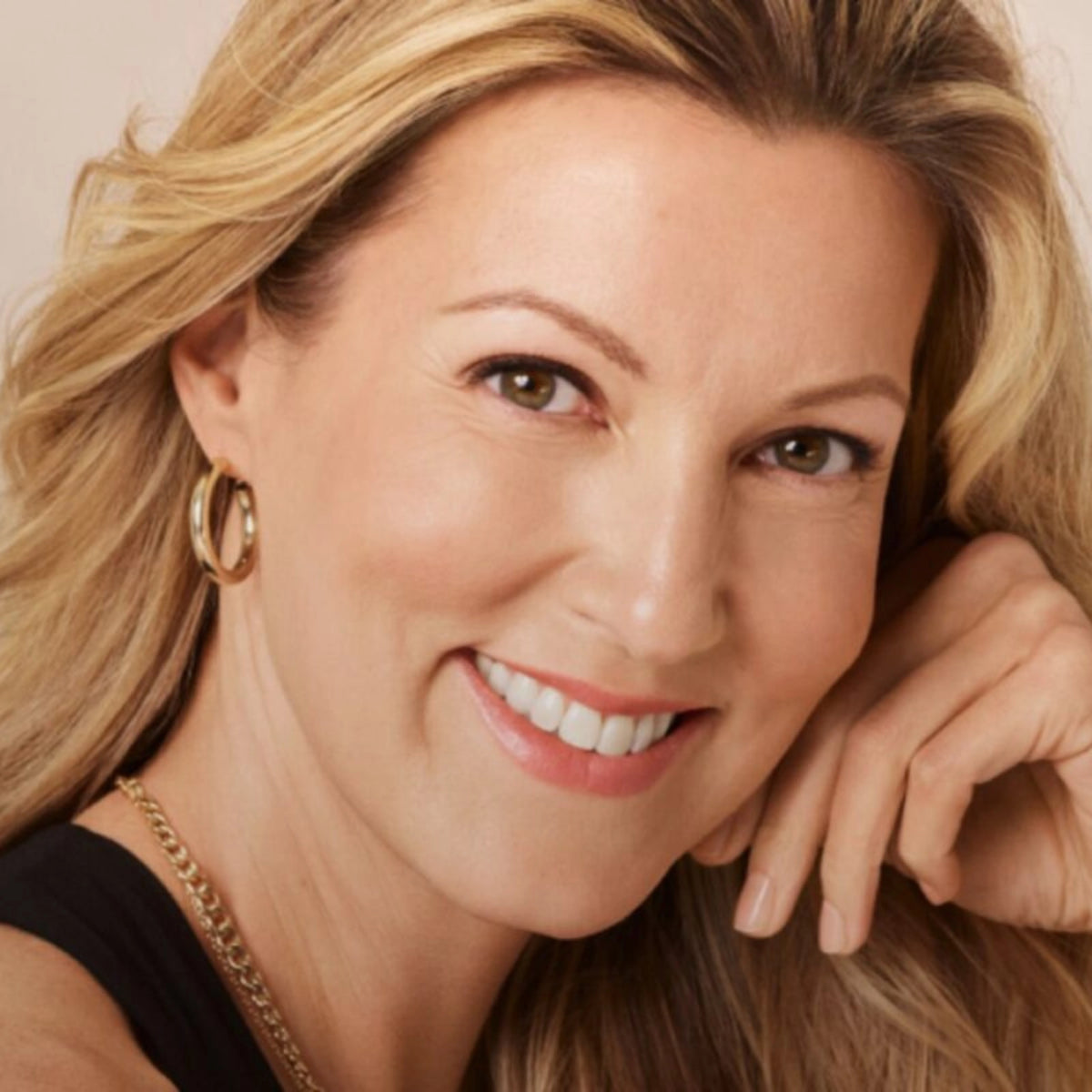 Florida_Aesthetics_product_Sculptra_Aesthetics_BOGO_50_Percent_Collagen_Stimulation